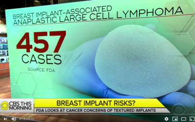 CBS NEWS – FDA weighs possible cancer risks of textured breast implants